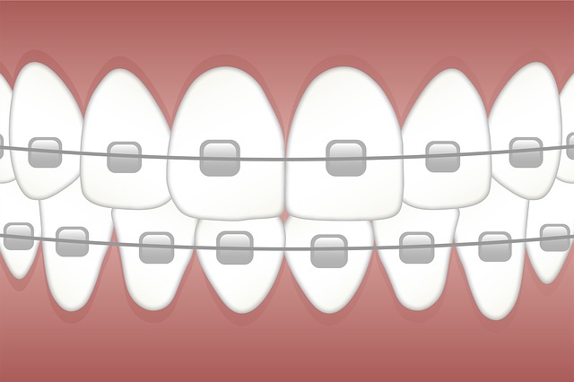 Kresba rovnátek na zuby